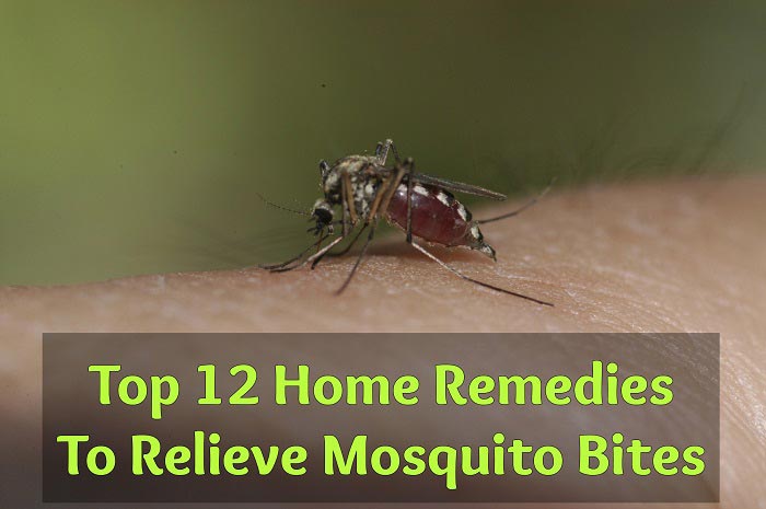 Top 12 Home Remedies To Relieve Mosquito Bites