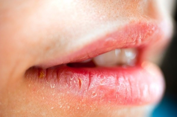 8-warning-signs-your-lips-are-sending-you