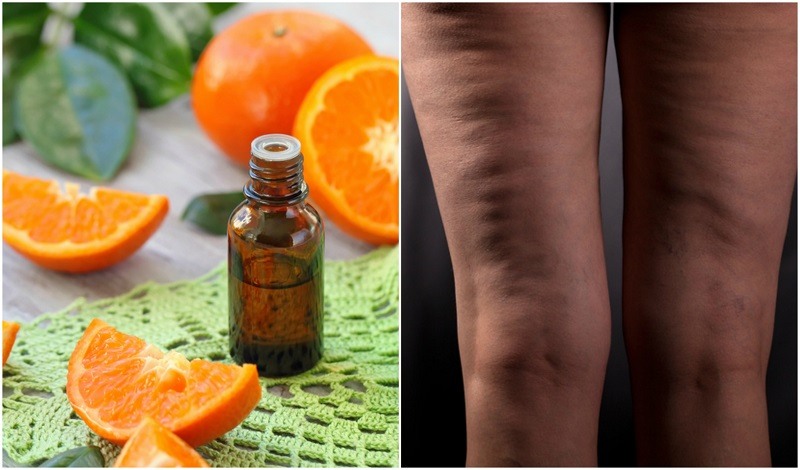 grapefruit oil for cellulite before and after